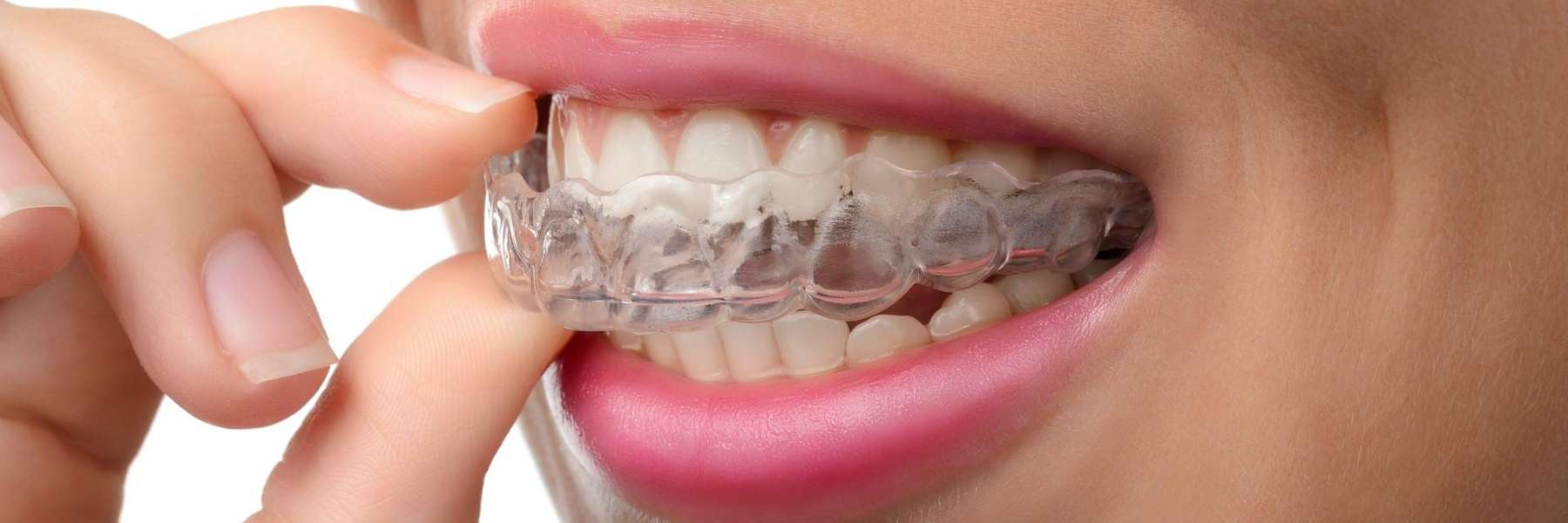close up of woman using invisalign