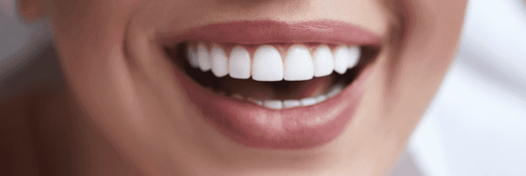 Woman showing her white smile